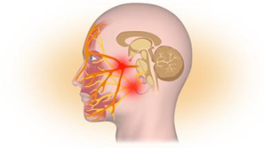 Невриты лицевого или тройничного нерва