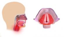 Хронический ларингит