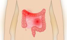 Энтероколит